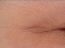 Before and after skin comparison