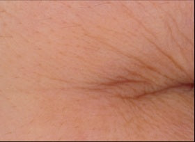 Before and after skin comparison